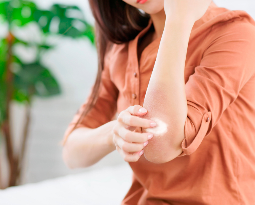 Ost Apotheke Dachau-Kosmetik - LINOLA - fuer - gereizte und entzuendende Haut -Neurodermitis - Intensiv-Pflege
